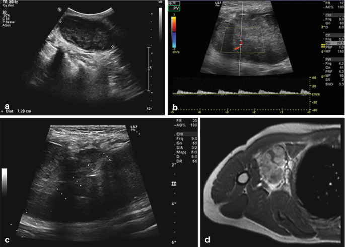 figure 23