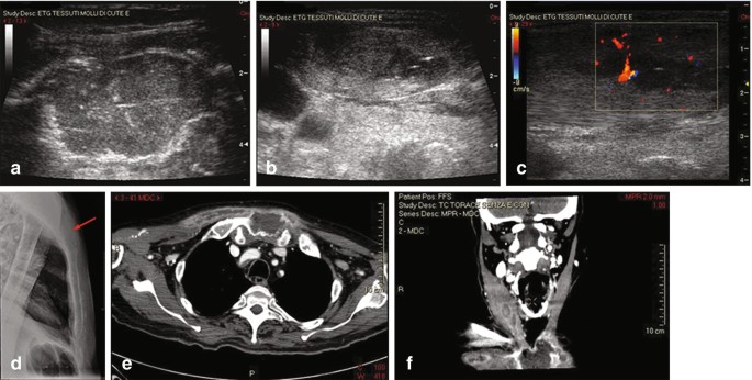 figure 29