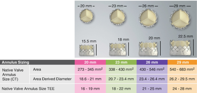 Valve Sizing | SpringerLink