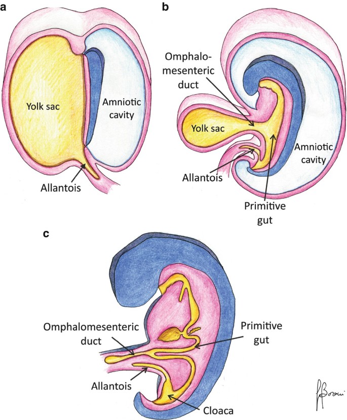 Omphalomesenteric Duct and Urachal Remnants | SpringerLink