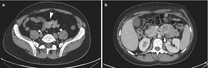 figure 23