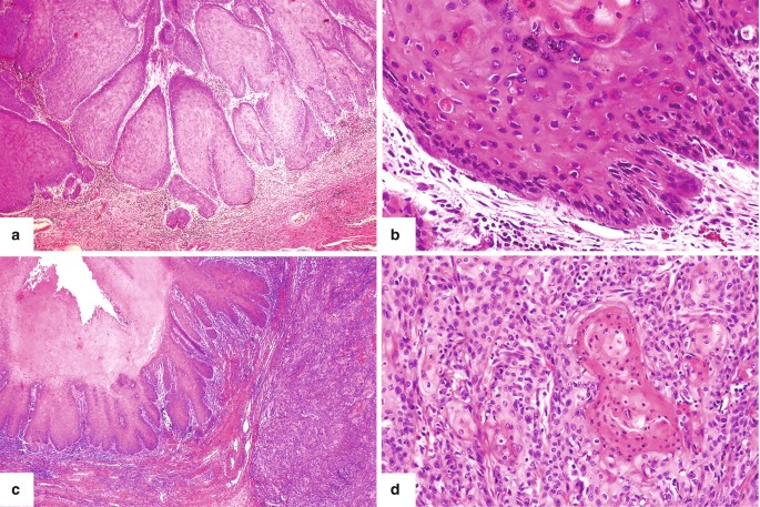 figure 105