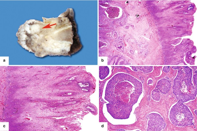 figure 116