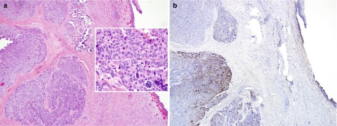 figure 28