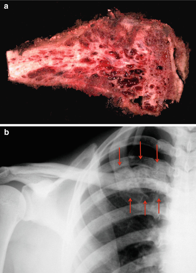 figure 164