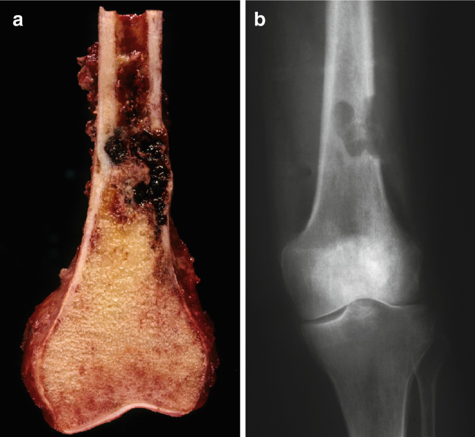 figure 167