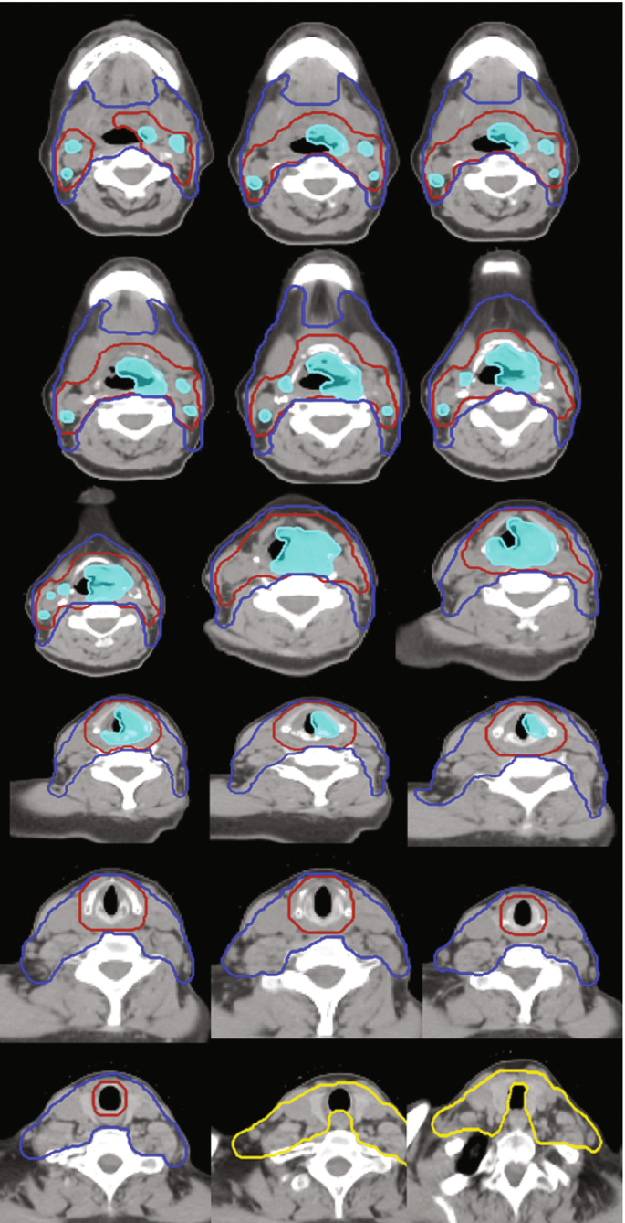 figure 18