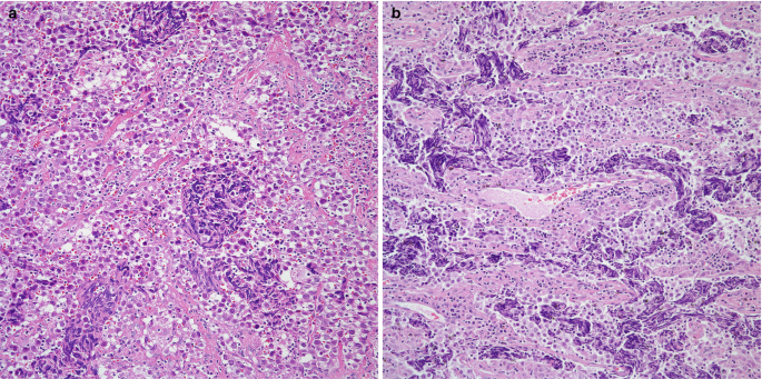 figure 31