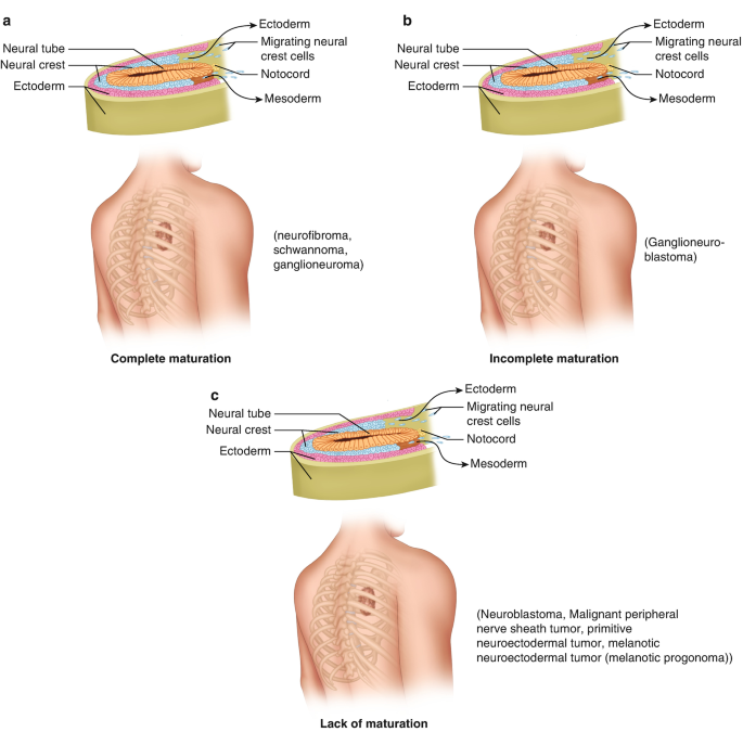 figure 32