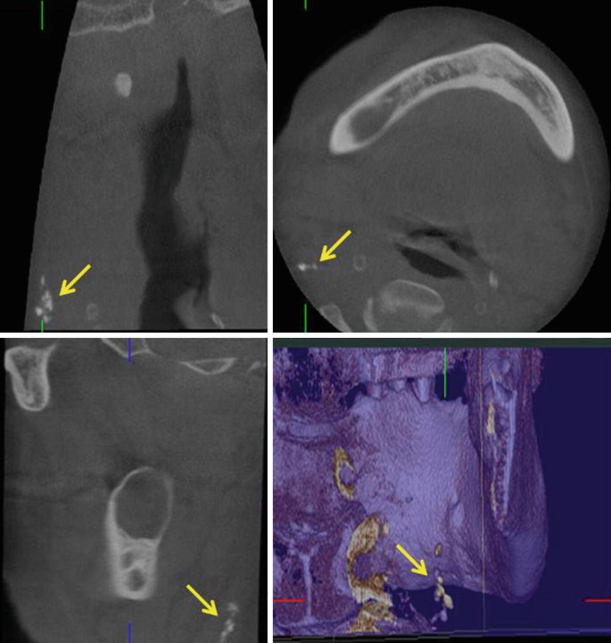 figure 25