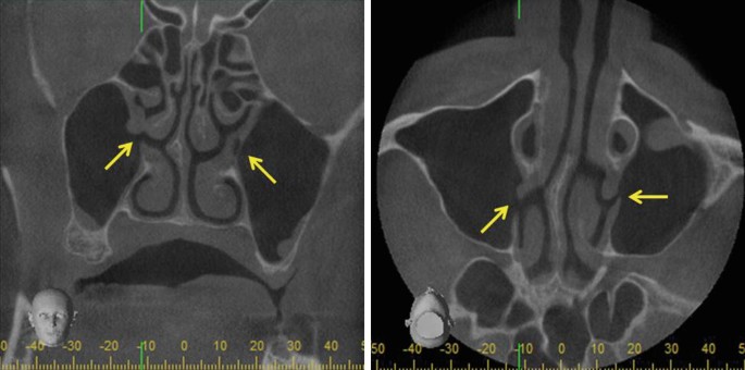 figure 35