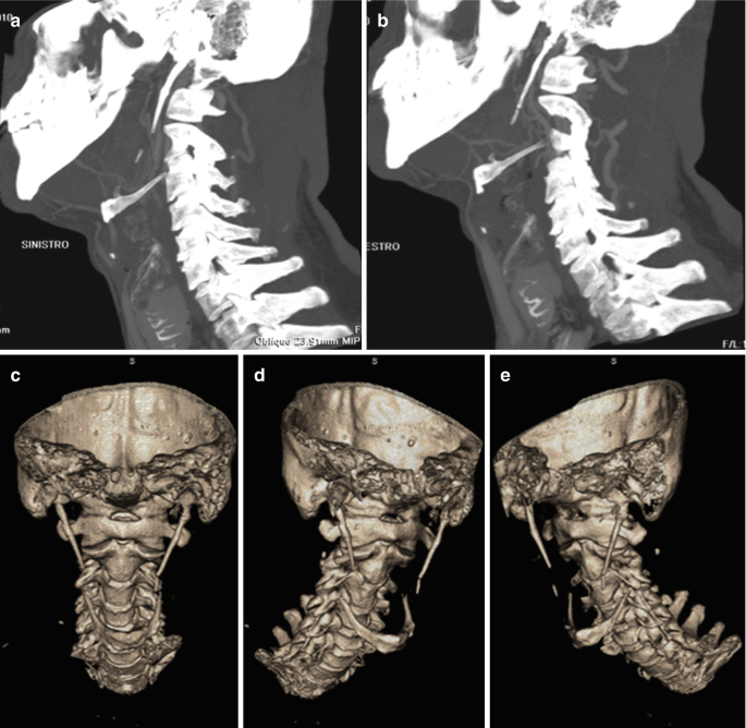 figure 23