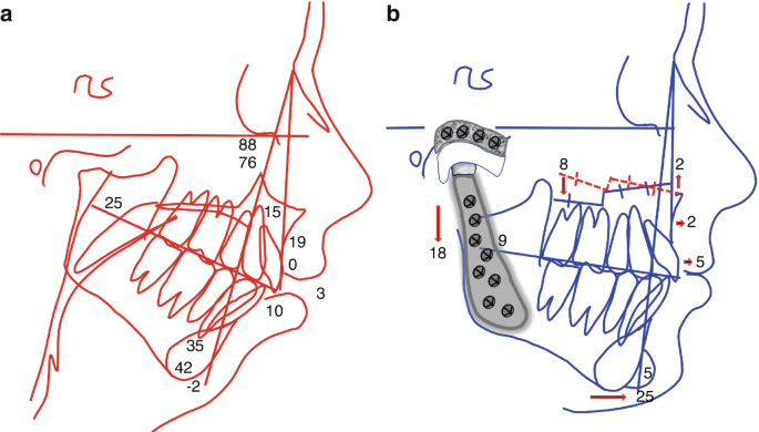 figure 32