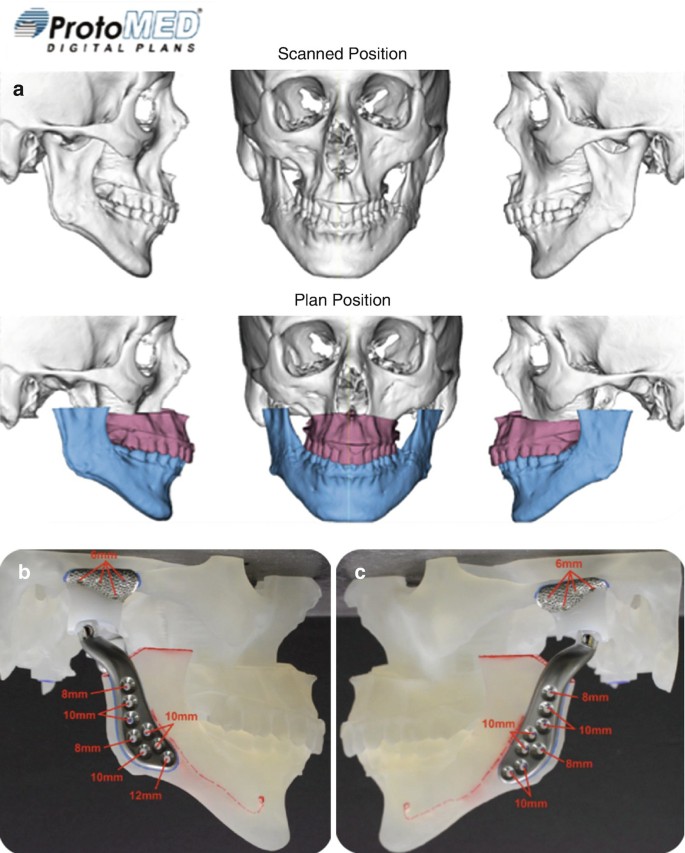 figure 38