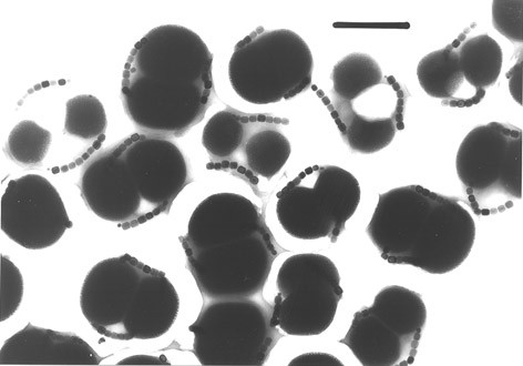 Calculation of L, ΔL and θ. Hypothetical lake–stream phenotypic