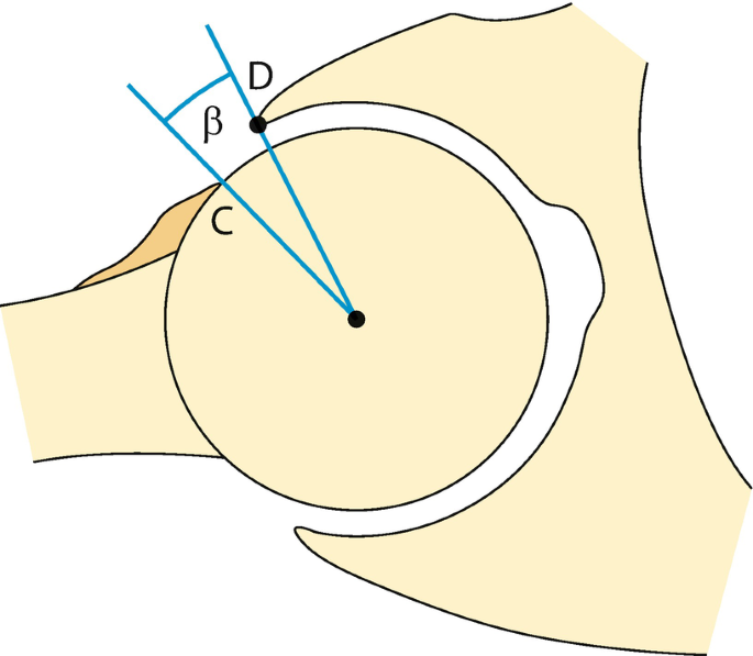 figure 33