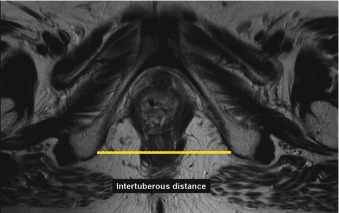 figure 41