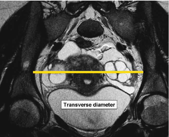 figure 43