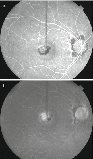 https://media.springernature.com/lw685/springer-static/image/chp%3A10.1007%2F978-3-540-75387-2_125/MediaObjects/118191_1_En_125_Fig3_HTML.gif