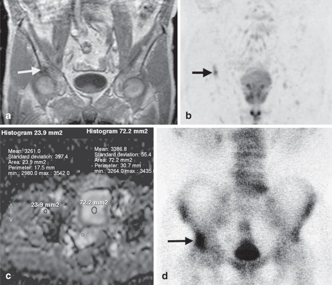 figure 13_13