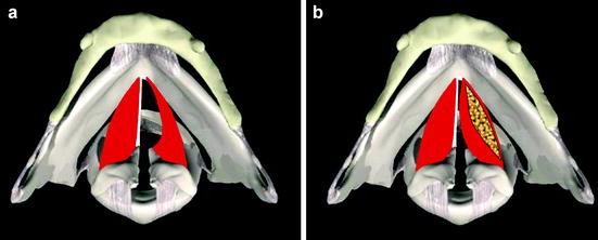 figure 9_17