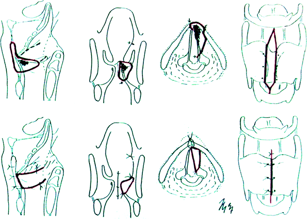 figure 2_18