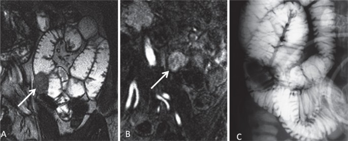 figure 16