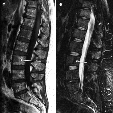 figure 1_7