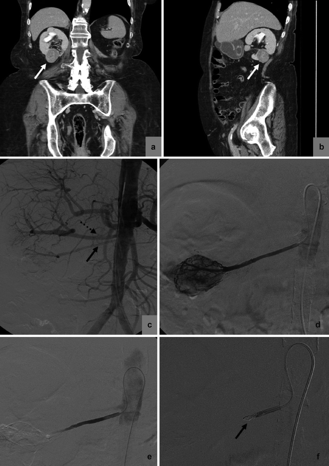 figure 22