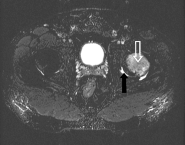 figure 11_8