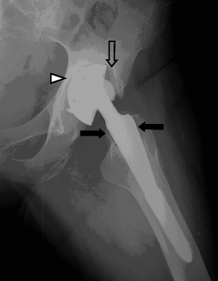 figure 14_8