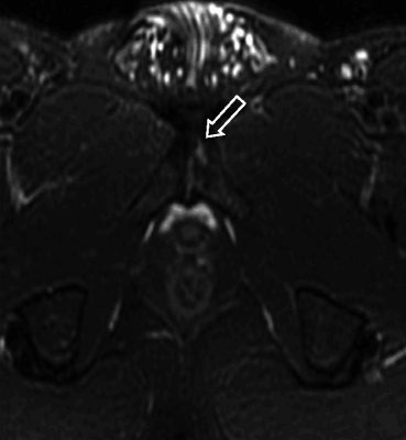 figure 26_8