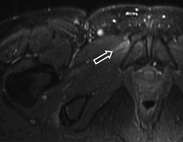 figure 27_8