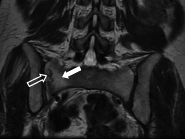 figure 2_8