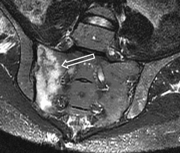 figure 3_8