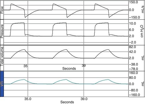 figure 34