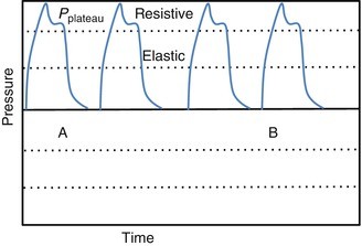 figure 42