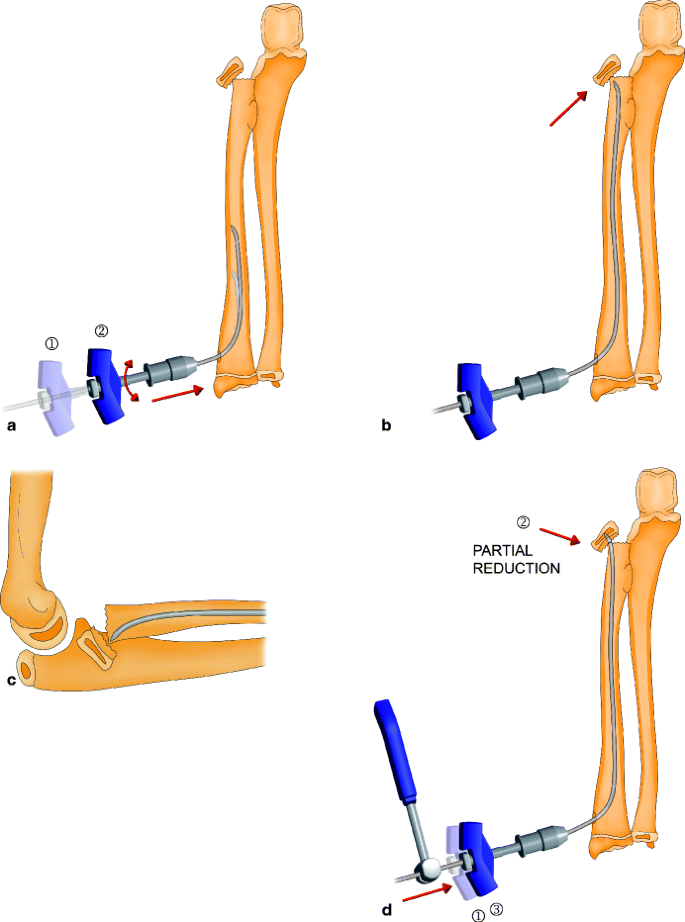 figure 6_15