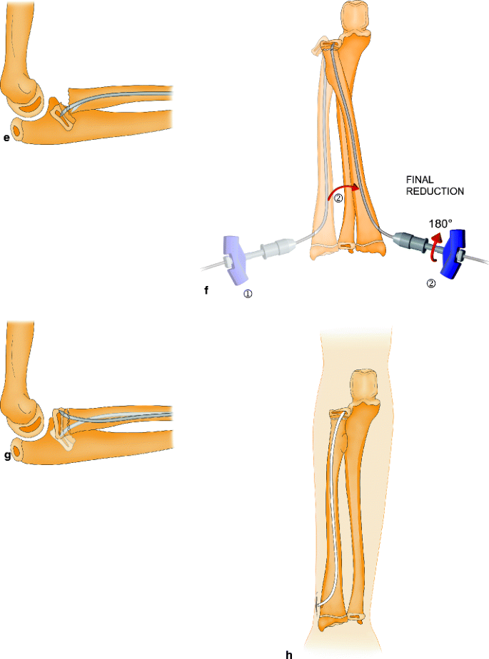 figure 6_15