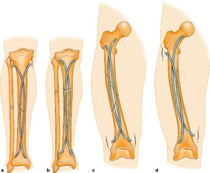 figure 1_5