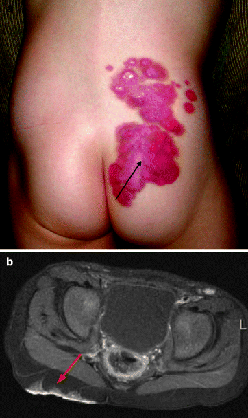 figure 18_43