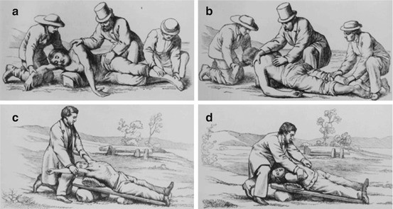 The History of Resuscitation | SpringerLink