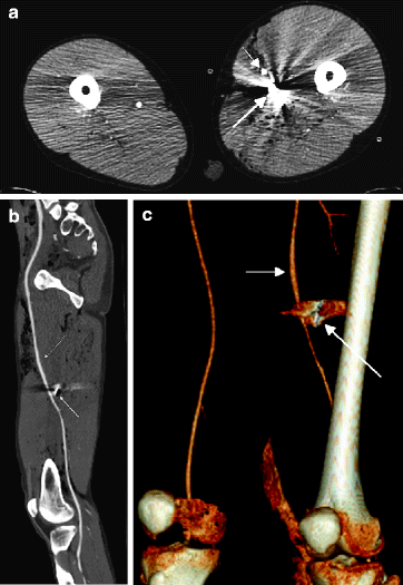 figure 31