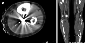 figure 32