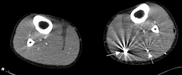 figure 34