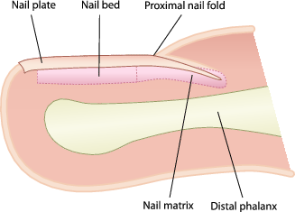 C12 Ingrown Toenail | SpringerLink C12 Ingrown Toenail | SpringerLink