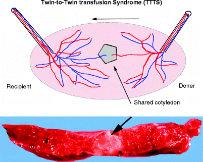 figure 68