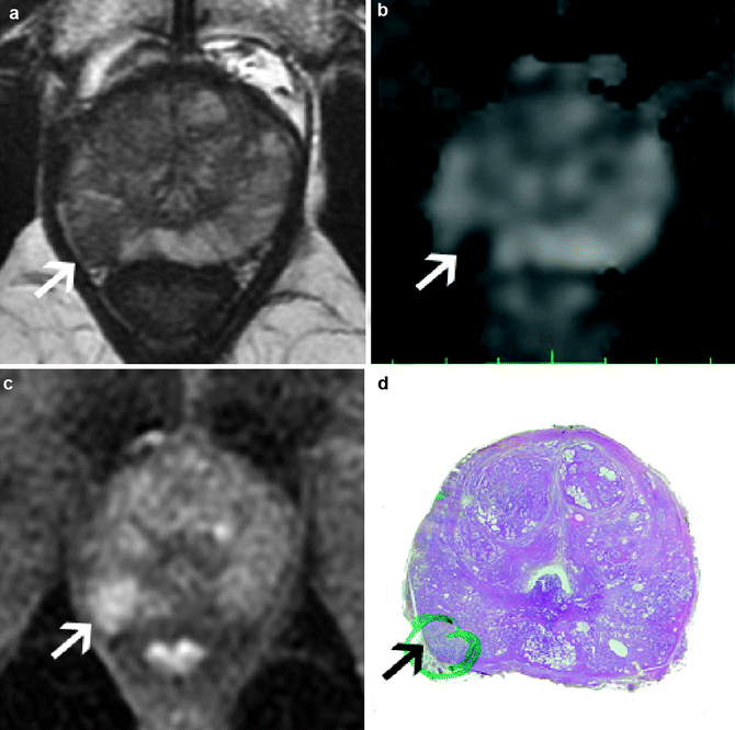 figure 2_15