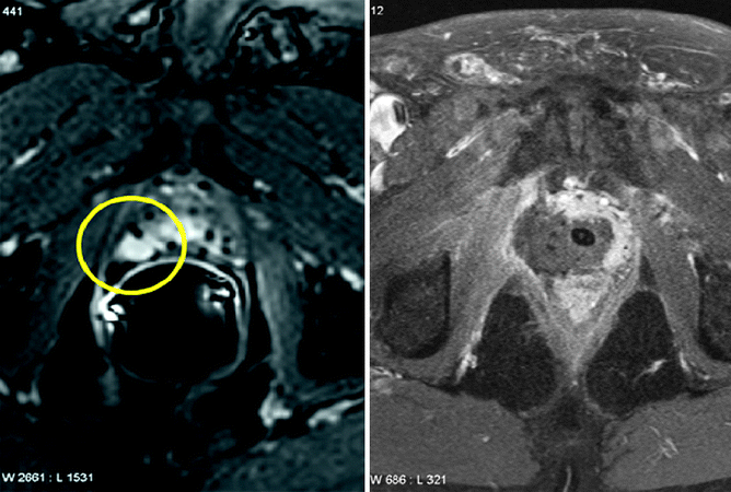 figure 14_15