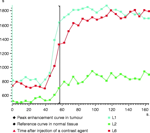 figure 3_6